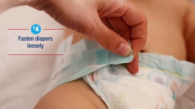 7 Tips To Treat And Prevent Diaper Rash ¦ Aquaphor Baby