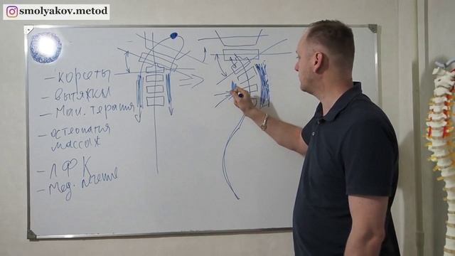 Медикаментозное лечение сколиоза