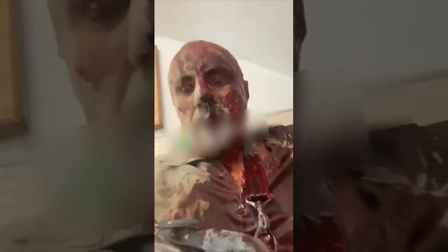 Раненый военный ВСУ записал видео после удара по учебному центру в Полтаве