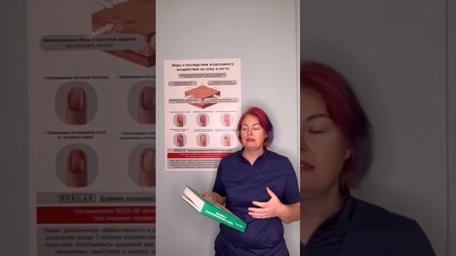 Помощь эксперта. Подногтевая гематома