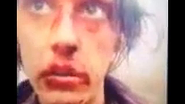 Валера,просто брови пощипай