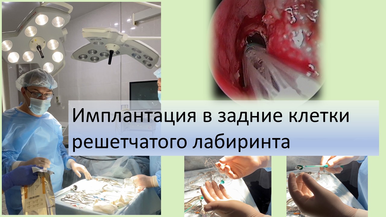 739c579b2004eb2d2342412235729037