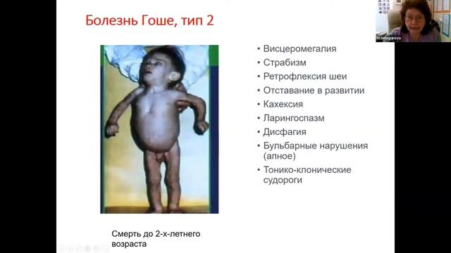 Редкие заболевания гепатоспленомегалией