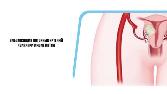 Рентгенхирургия и интервенционная радиология в Memorial Hospital Bishkek