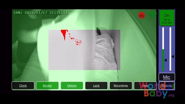 The SAMi-3 Seizure Monitor: How It Works