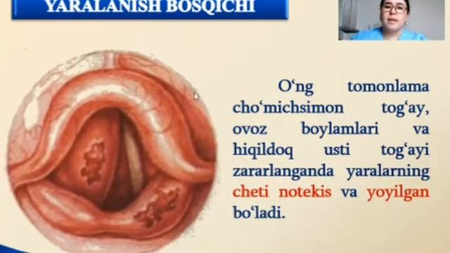 ЛОР аъзолари юкумли грунулемалари