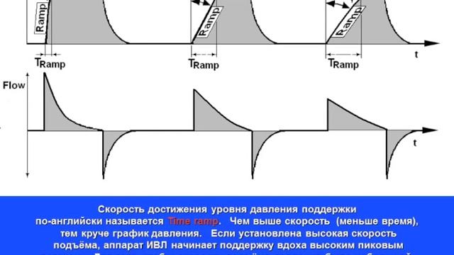 М-Класс ИВЛ 1 лек2 CMV
