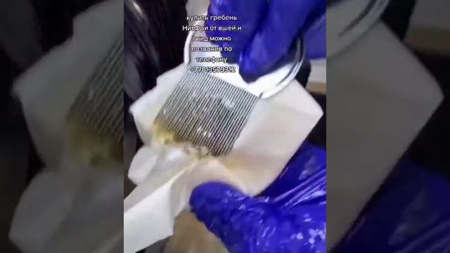 Средство от вшей и гнид! От педикулеза
