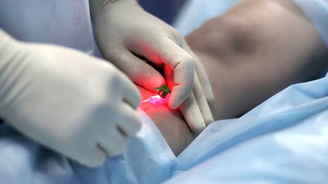 Кто такой флеболог. Аспекты лечения варикоза. Флеболог Мазынский Д.В