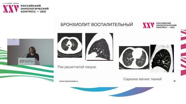 Выбор диагностических подходов при инфекциях у онкологических больных. Роль компьютерной томографии