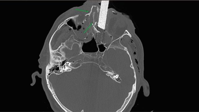 Неотложка + голова = иногда сложные кейсы.