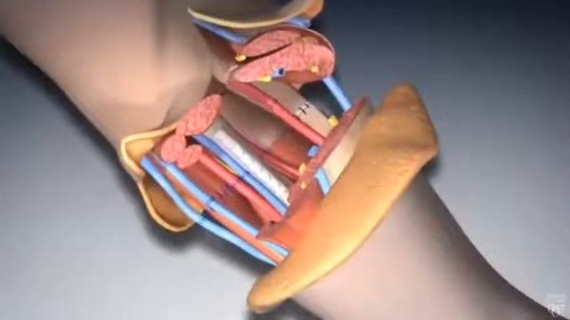 руководство по ремонту оторваний руки