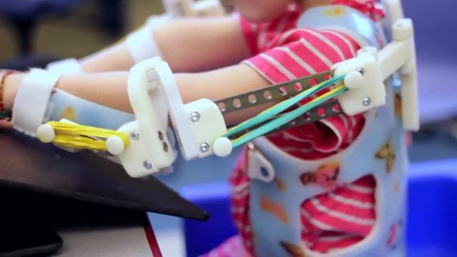 3D Printed Exoskeleton Lets Little Girl 