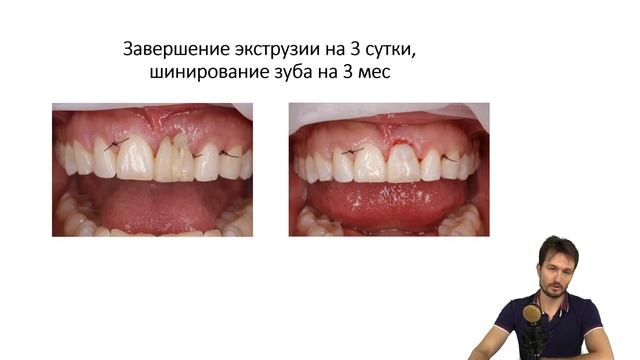Концепция сохранения зубов АПИКО.ПРО