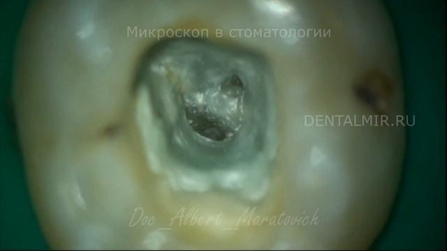 Без увеличения, практически нереально убрать все остатки 