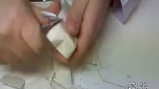 Sabund Ust 1  Premolar