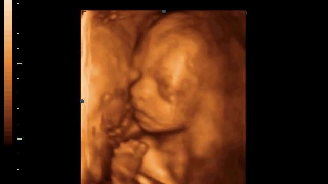 Узи 3d, 4d (23-24 неделя)