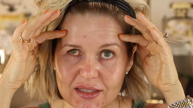 6 Month Ultherapy Update + Final Thoughts