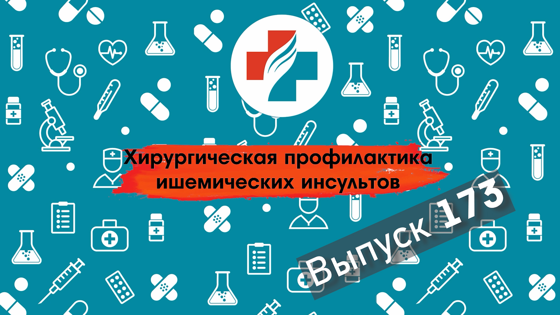 173 выпуск. Как избежать инсульта. Лечение атеросклероза. Сосудистый хирург.