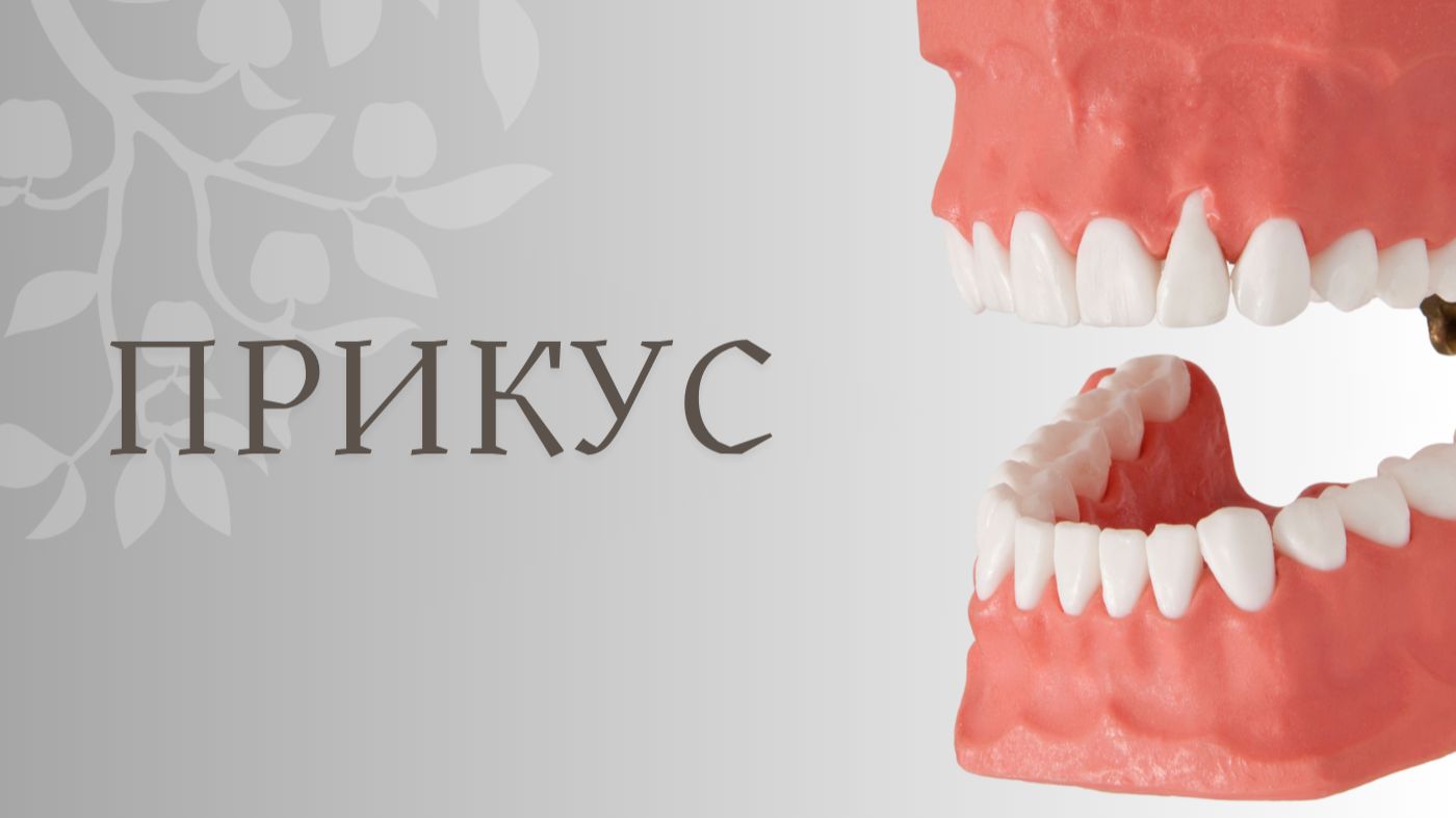 Прикус