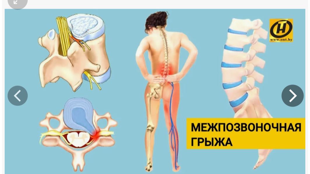 Позвоночник