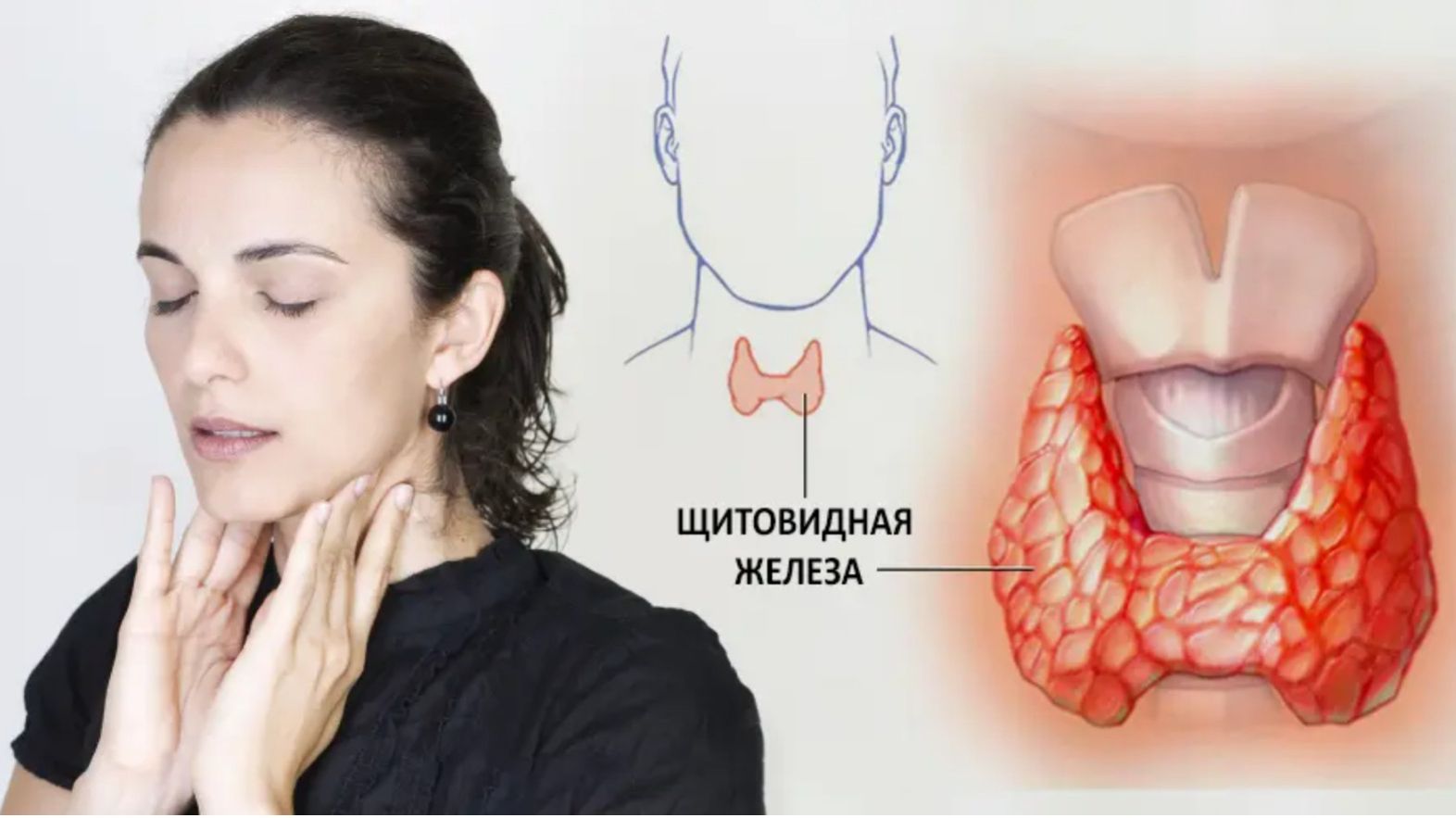 Заболевания щитовидной железы: