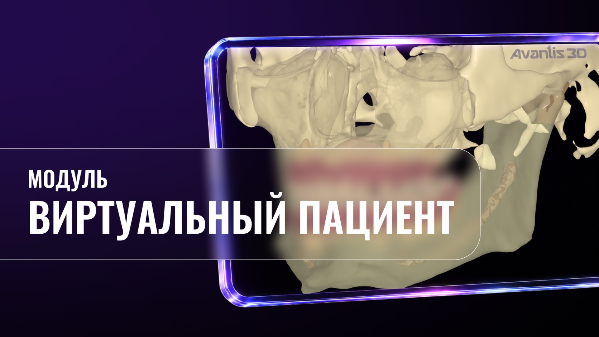 Виртуальный пациент (Avantis 3D)