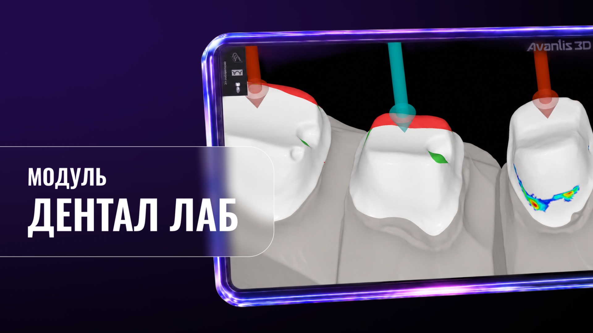 Дентал лаб (Avantis 3D)