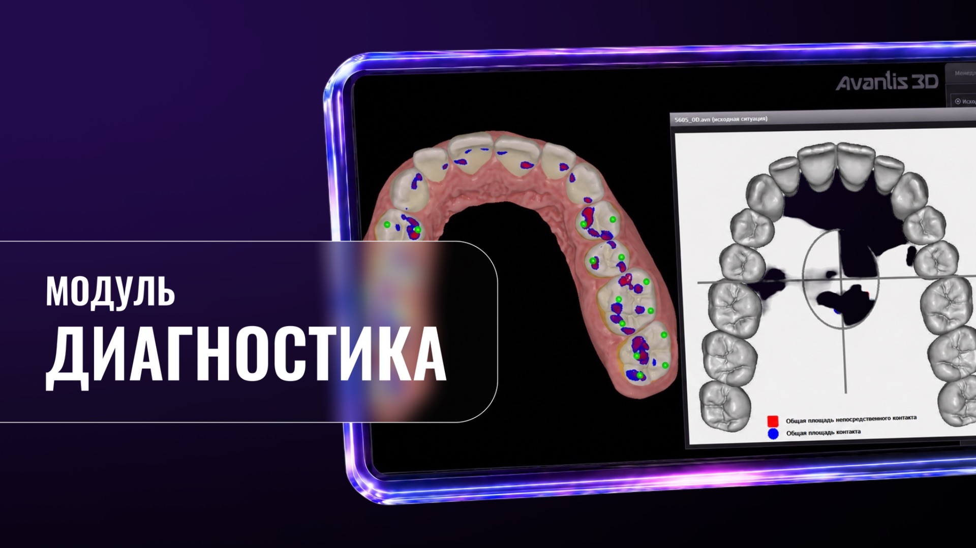 Диагностика (Avantis 3D)