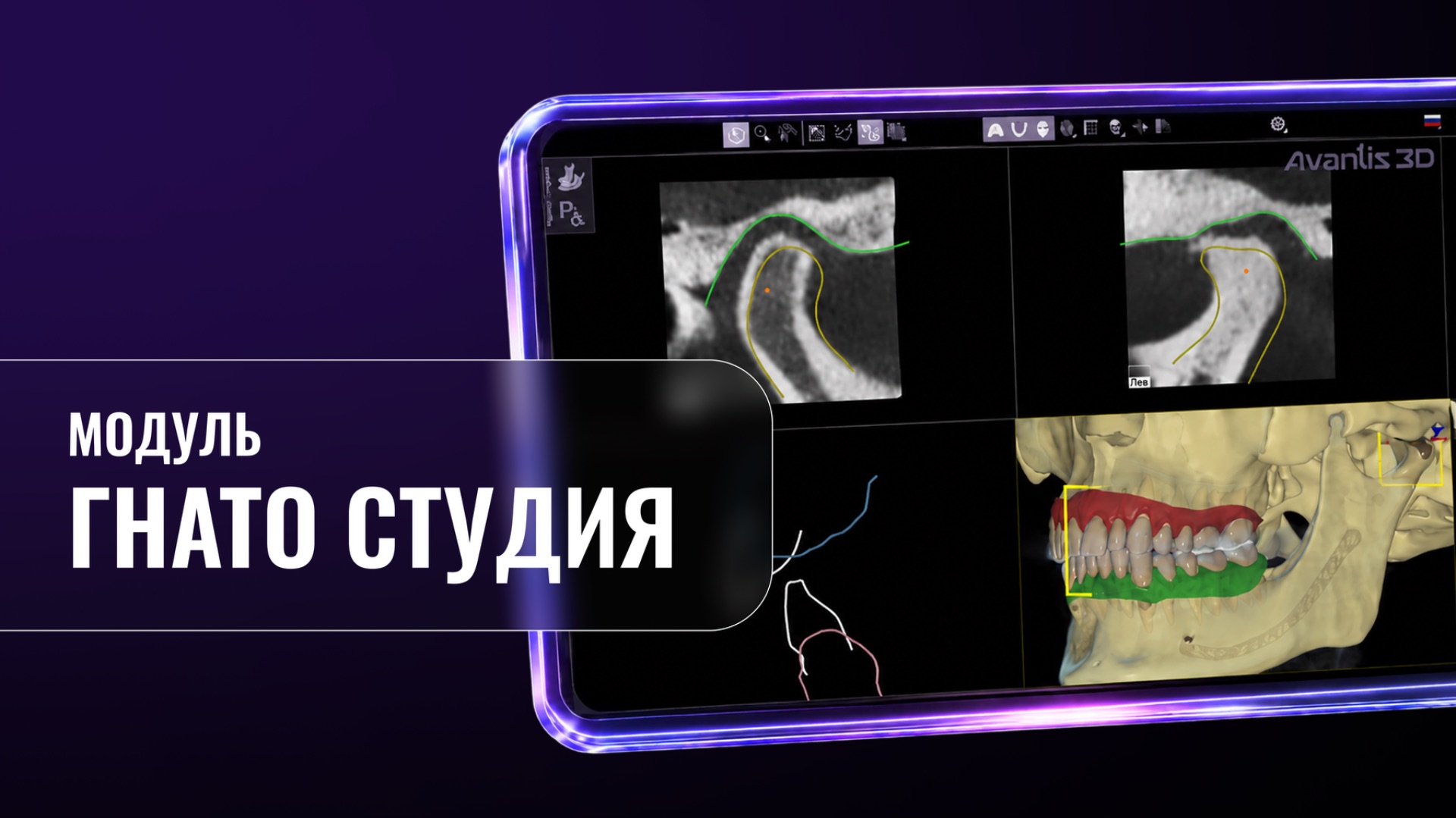 Гнато студия (Avantis 3D)