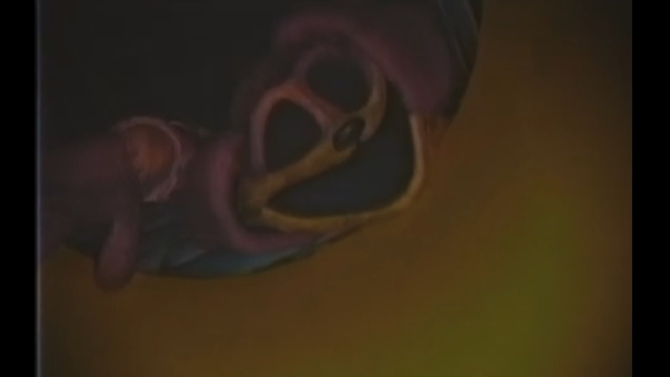 VHS