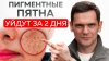 Роман Сухинин_Любая пигментация уйдет за ситанные ДНИ!