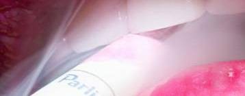 всякая хрень