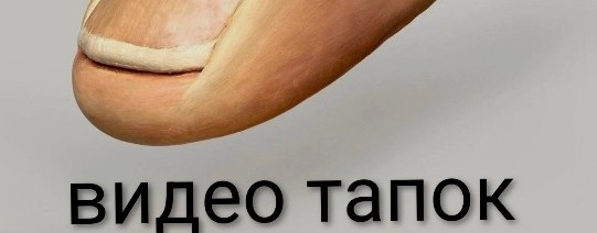 Видео Тапок