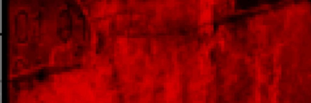 Дурка нашего двора