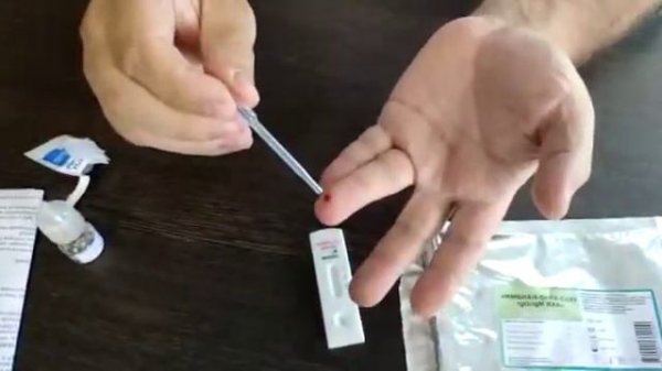 Экспресс-тест Imbian