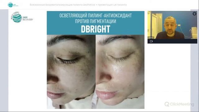 Запись Вебинара 