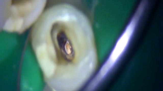 Пропущенный канал смотреть онлайн