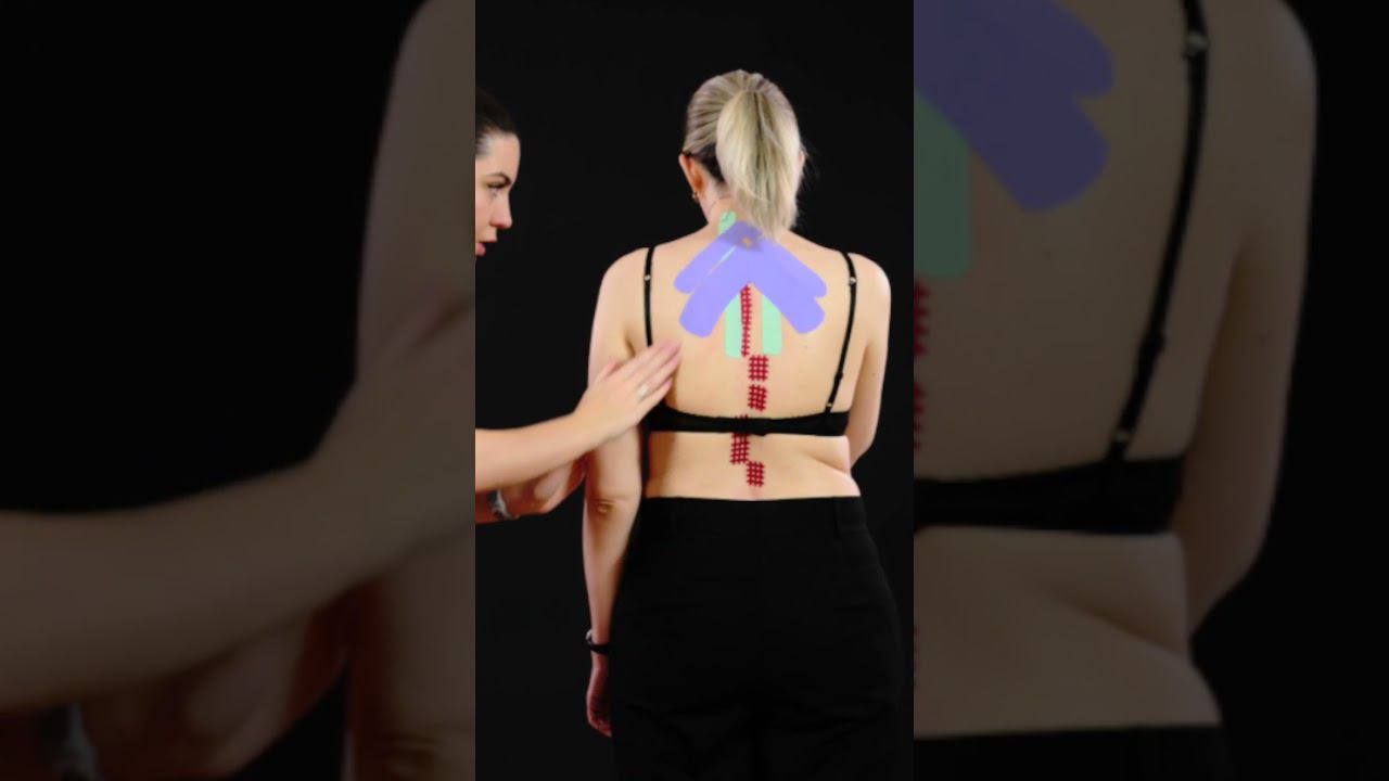 Работа с болью в спине специалистом по тейпированию. Полное видео у нас на канале BBalance смотреть онлайн