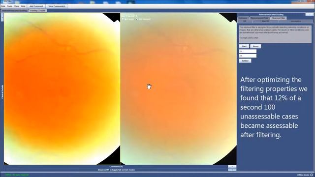 Clearvue Filter смотреть онлайн