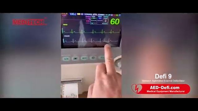 How to use manual defibrillator to save a life ? ( Meditech Defi9) смотреть онлайн