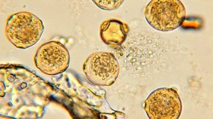 Пыльца березы водная эмульсия под микроскопом (собрана во время цветения березы)