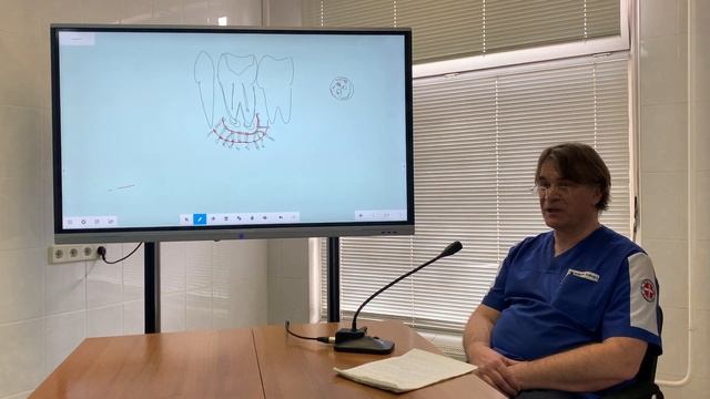 Тема 5. Острый остеомиелит челюстей.