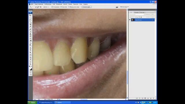 Как убрать дефект желтых зубов! - Видео урок №4. смотреть онлайн