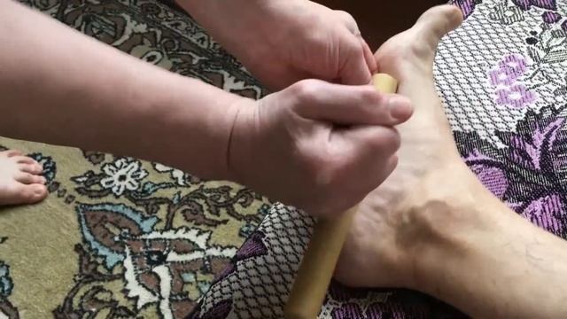 Пяточная шпора. Как я быстро ее вылечил в домашних условиях. Упражнения. Отзыв смотреть онлайн