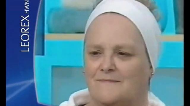 Нанотехнологии против морщин. Результаты.