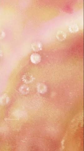 What an Injection looks like through the Microscope. смотреть онлайн