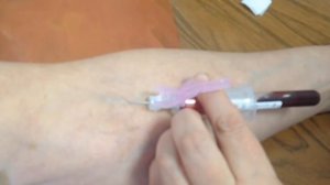 Техника взятия крови из вены вакуумной системой.