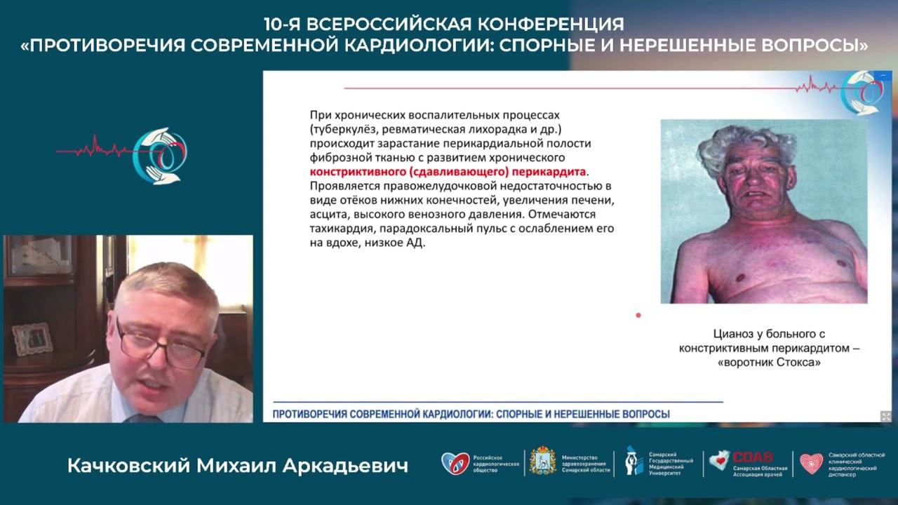 13 11 Научный Симпозиум Сложные Вопросы Ведения Пациентов Спроси Эксперта смотреть онлайн