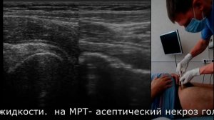 Синовит,блокада тазобедренного сустава под узи пункция